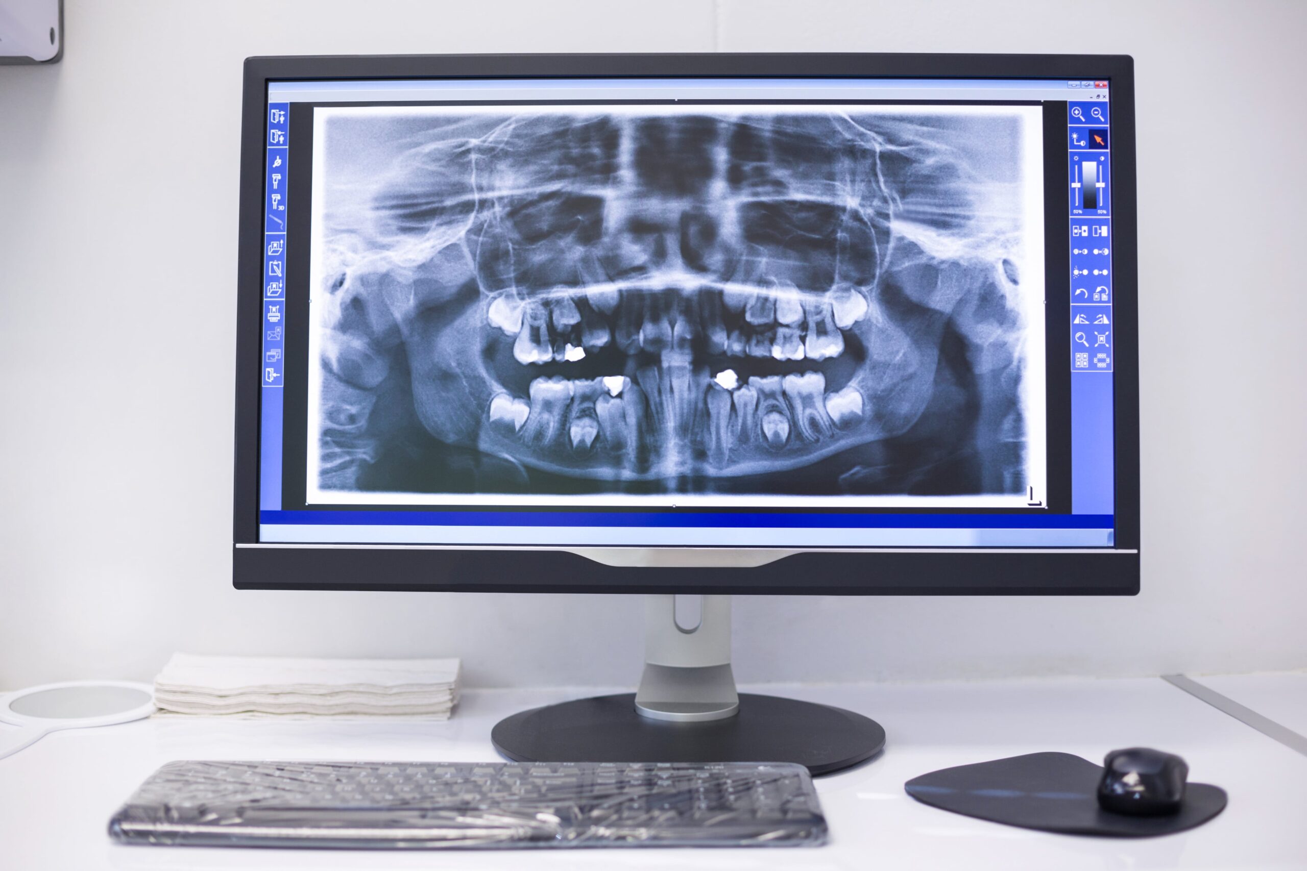 an-x-ray-on-the-monitor